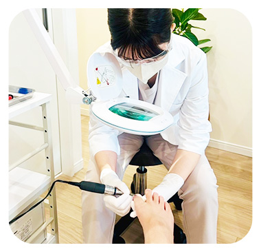 巻き爪の矯正風景